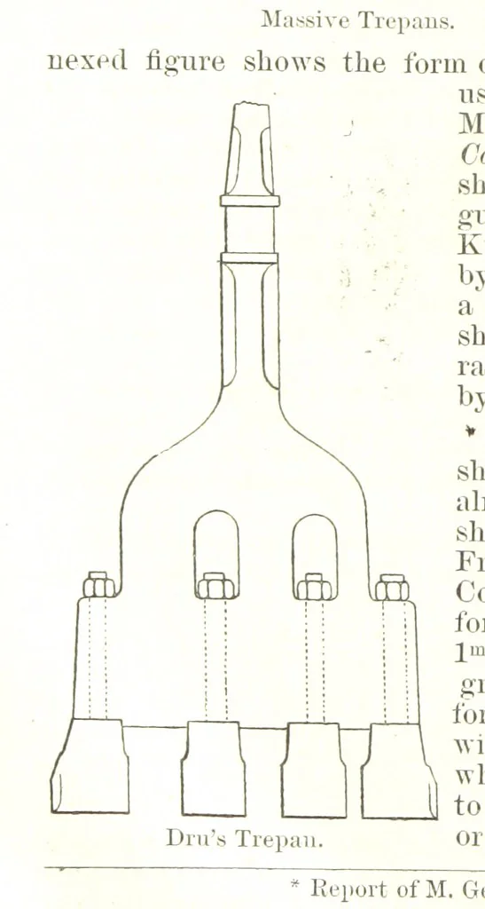 An illustration from Notices of Mining Machinery and various mechanical appliances in use chiefly in the Pacific States and Territories, for mining, raising, and working ores, etc, 1871, leaf 82