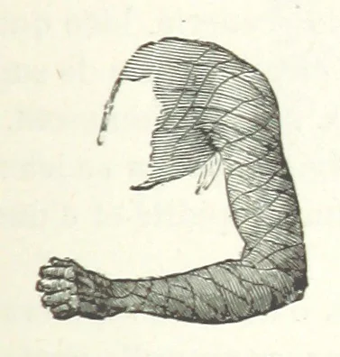 An illustration from Dernier Journal du docteur David Livingstone relatant des explorations et découvertes de 1866 à 1873, suivi du récit de ses derniers moments rédigé d'après le rapport de ... Chouma et Souzi par H. Waller. ... Ouvrage traduit de l'anglais ... par Mme. H. Loreau et contenant 60 gravures et 4 cartes, 1876, leaf 157