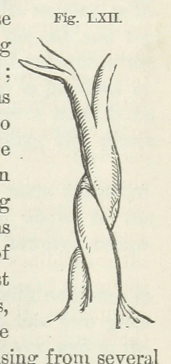 An illustration from Works. Popular edition.] 2 series, 1886, leaf 323