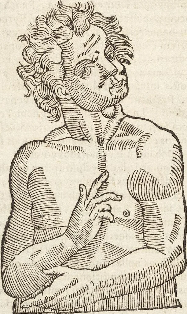 An illustration from Vlyssis Aldrovandi Patricii Bononiensis Monstrorvm Historia: cum Indice copiosissimo, 1642, leaf 116