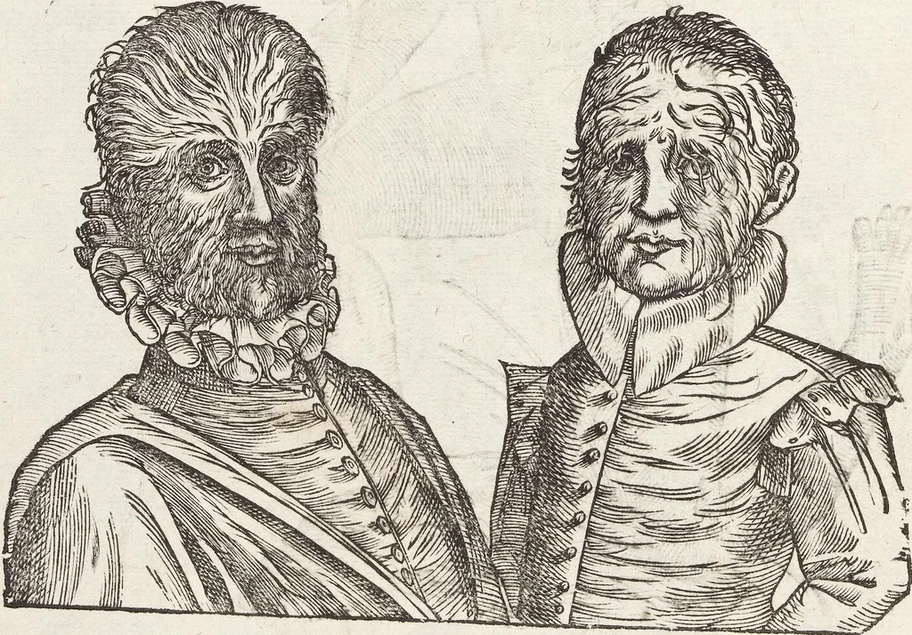 An illustration from Vlyssis Aldrovandi Patricii Bononiensis Monstrorvm Historia: cum Indice copiosissimo, 1642, leaf 34