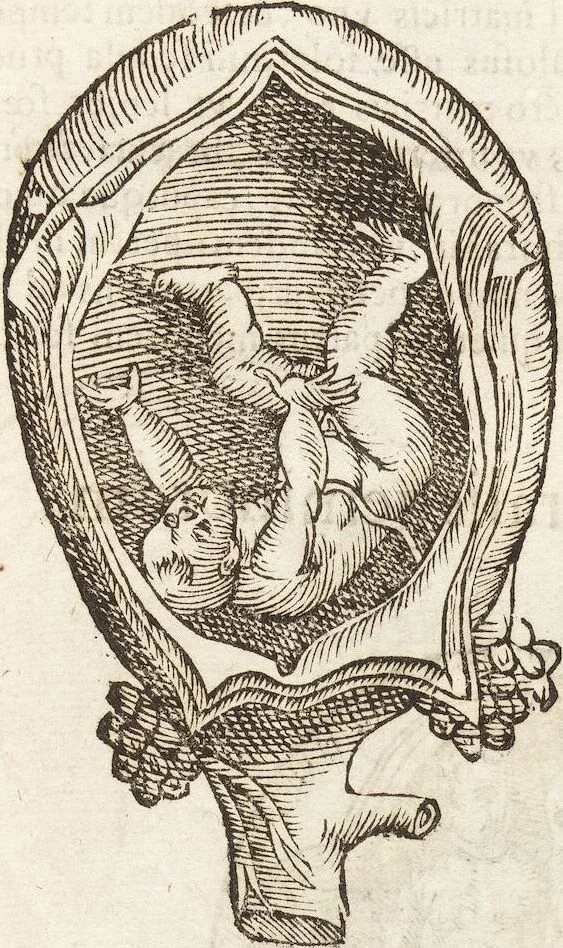 An illustration from Vlyssis Aldrovandi Patricii Bononiensis Monstrorvm Historia: cum Indice copiosissimo, 1642, leaf 79