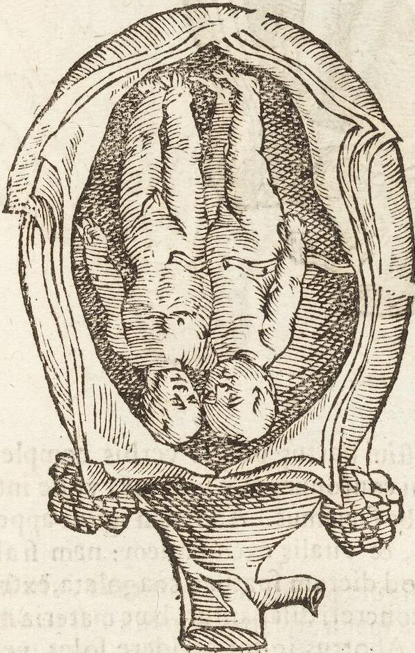 An illustration from Vlyssis Aldrovandi Patricii Bononiensis Monstrorvm Historia: cum Indice copiosissimo, 1642, leaf 79