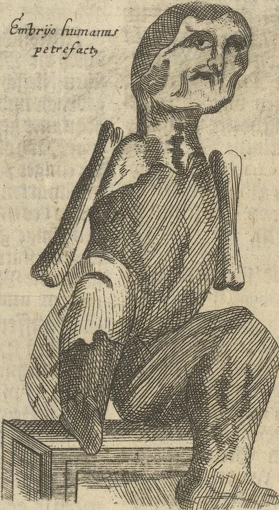 An illustration from Museum Museorum, Oder Vollständige Schau-Bühne Aller Materialien und Specereÿen: Nebst deren Natürlichen Beschreibung/ Election, Nutzen und Gebrauch/ Aus andern Material- Kunst- und Naturalien-Kammern/ Oost- und West-Indischen Reiß-Beschreibungen/ Curiosen Zeit- und Tag-Registern/ Natur- und Artzney-Kündigern/ wie auch selbst-eigenen Erfahrung ..., 1704, leaf 453