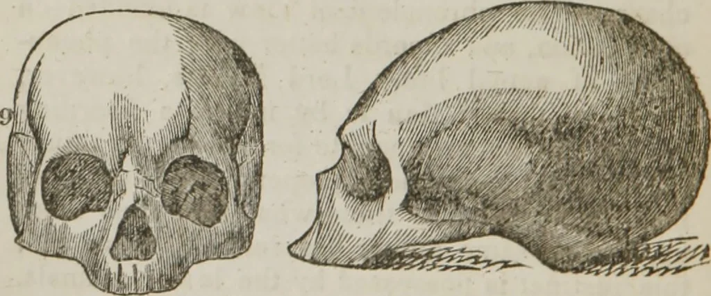 An illustration from Elements of phrenology, 1845, leaf 105