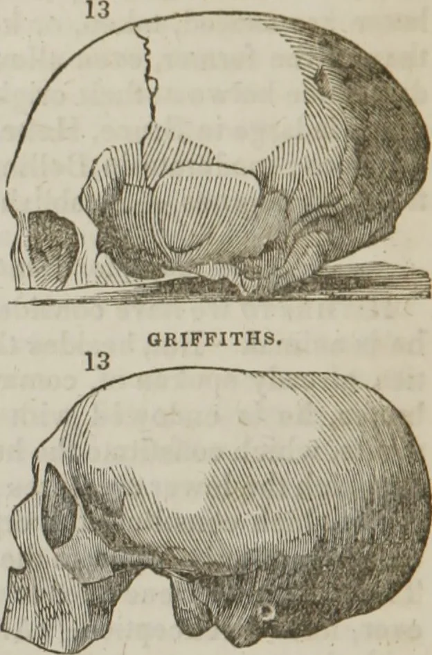 An illustration from Elements of phrenology, 1845, leaf 117