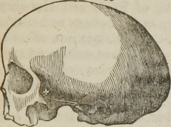 An illustration from Elements of phrenology, 1845, leaf 120