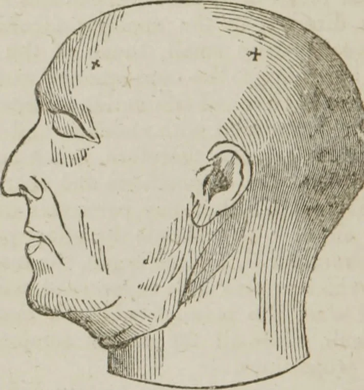 An illustration from Elements of phrenology, 1845, leaf 217