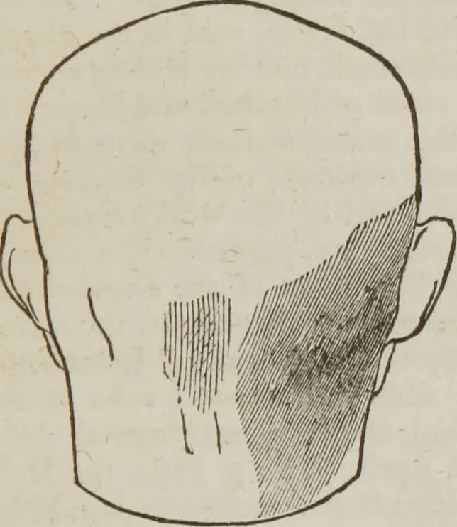 An illustration from Elements of phrenology, 1845, leaf 84
