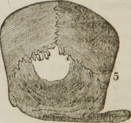 An illustration from Elements of phrenology, 1845, leaf 93