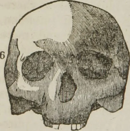 An illustration from Elements of phrenology, 1845, leaf 95