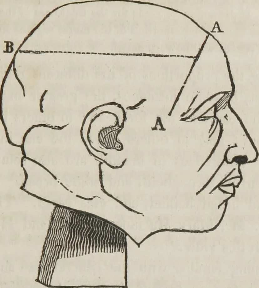 An illustration from A system of phrenology, 1834, leaf 100