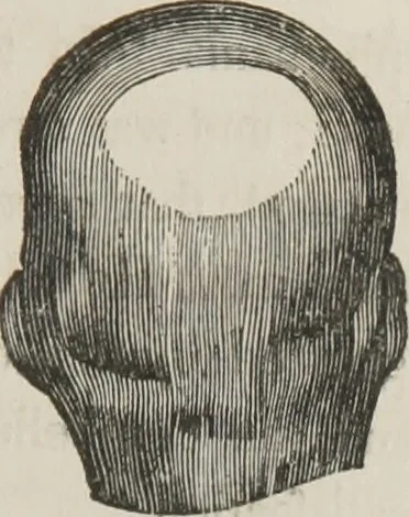 An illustration from A system of phrenology, 1834, leaf 128