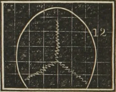 An illustration from A system of phrenology, 1834, leaf 255