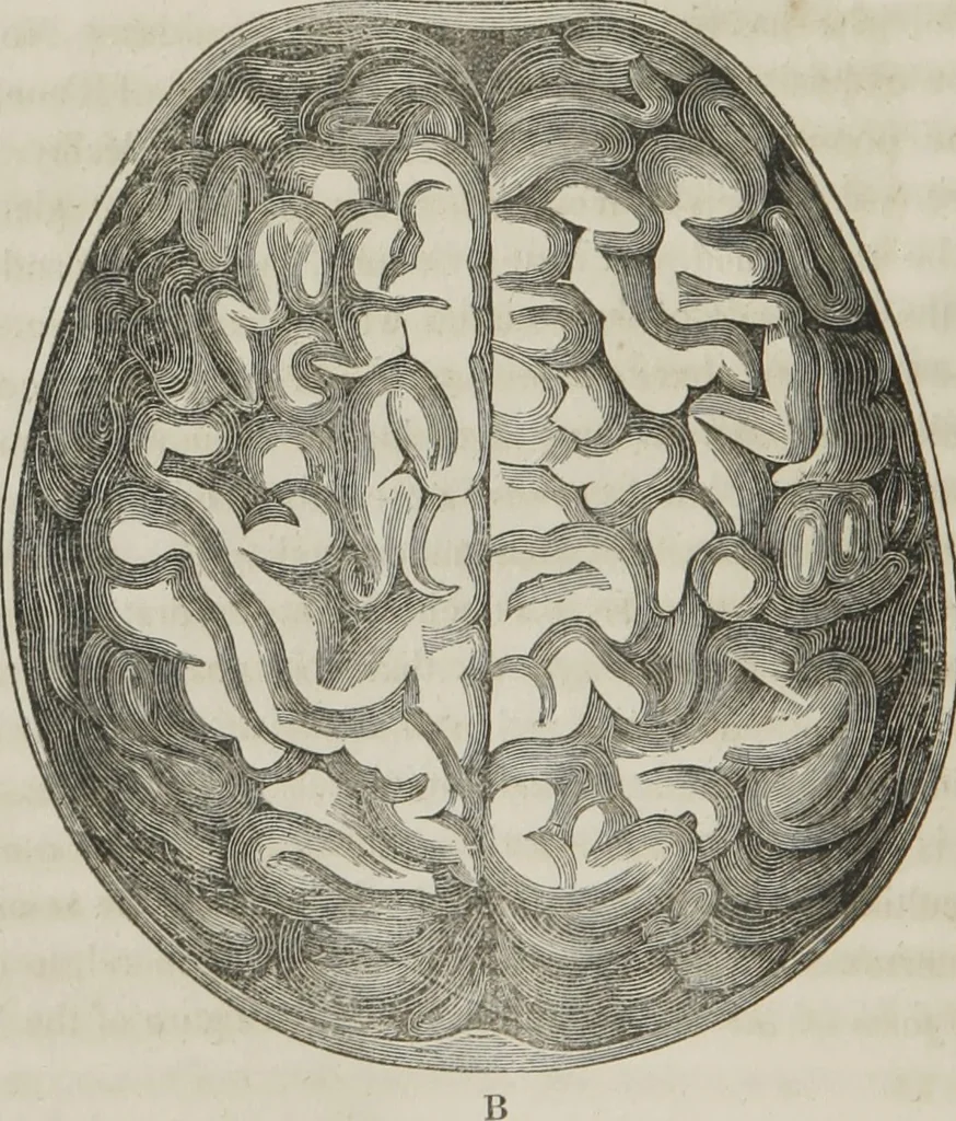 An illustration from A system of phrenology, 1834, leaf 85