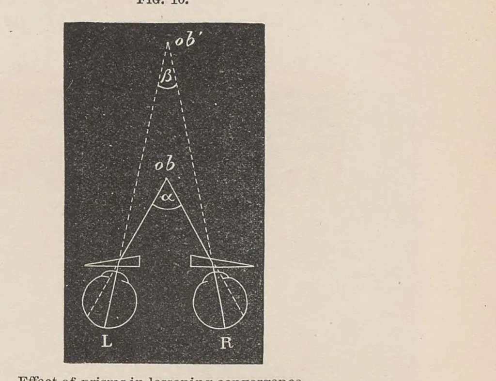 An illustration from Diseases of the eye, 1900, leaf 30