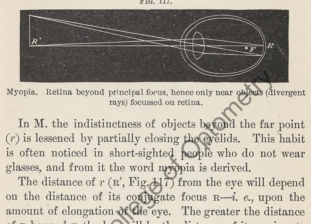 An illustration from Diseases of the eye, 1900, leaf 342