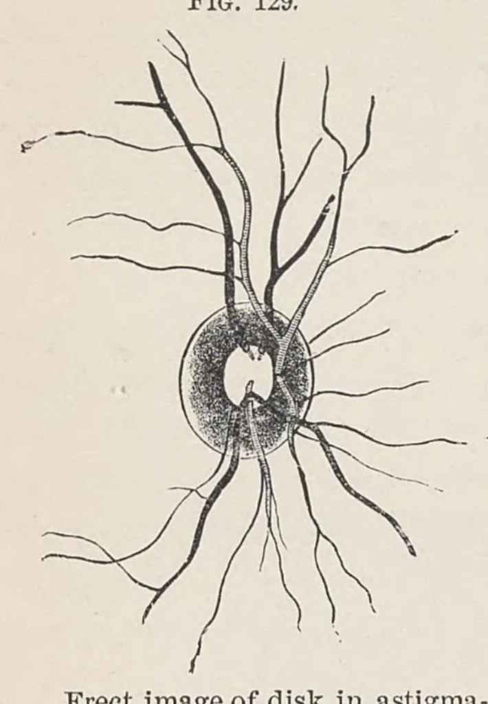 An illustration from Diseases of the eye, 1900, leaf 367