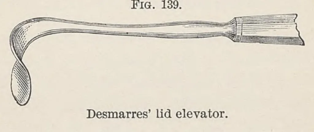 An illustration from Diseases of the eye, 1900, leaf 405