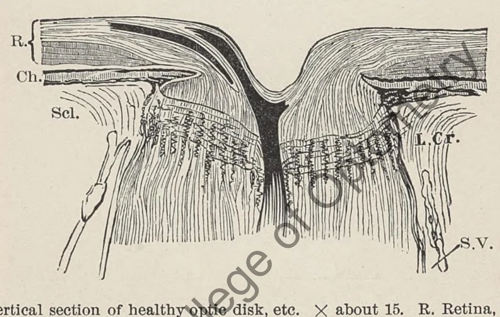 An illustration from Diseases of the eye, 1900, leaf 78