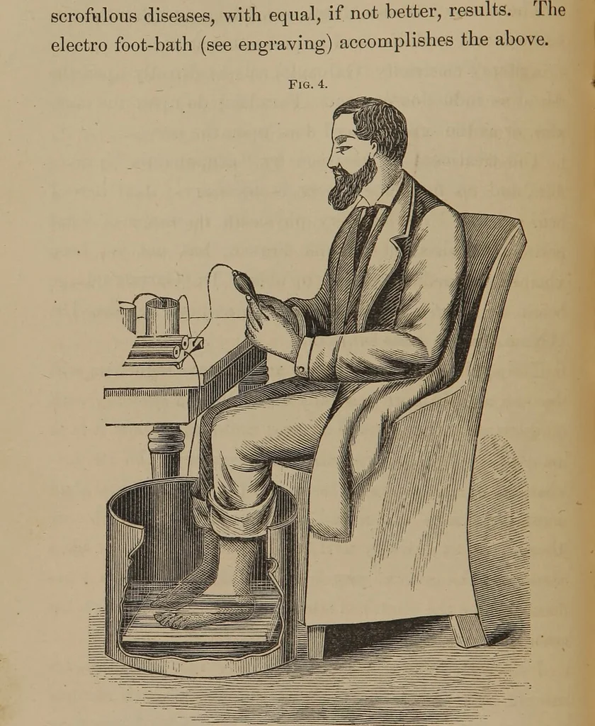 An illustration from The application of electricity as a therapeutic agent, 1877, leaf 47