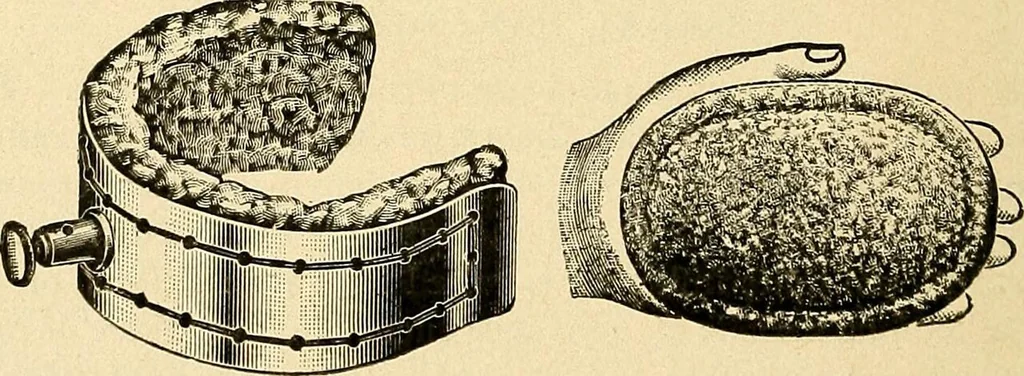 An illustration from The electro-therapeutic guide, or, A thousand questions asked and answered, 1907, leaf 100