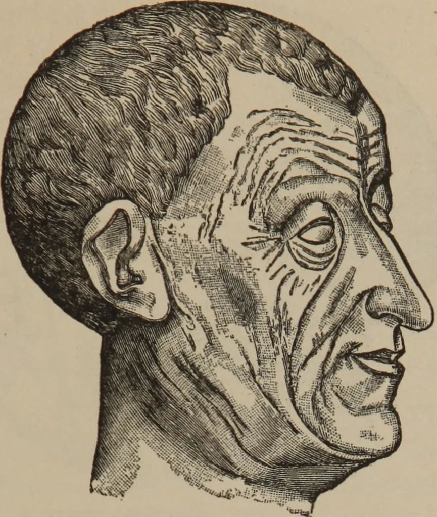 An illustration from The science of facial expression : the new system of diagnosis, based on original researches and discoveries, 1917, leaf 32