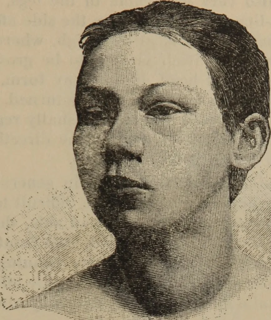 An illustration from The science of facial expression : the new system of diagnosis, based on original researches and discoveries, 1917, leaf 38