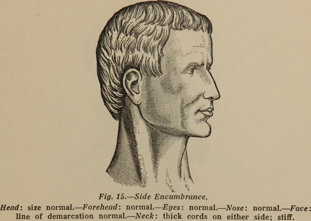 An illustration from The science of facial expression : the new system of diagnosis, based on original researches and discoveries, 1917, leaf 40