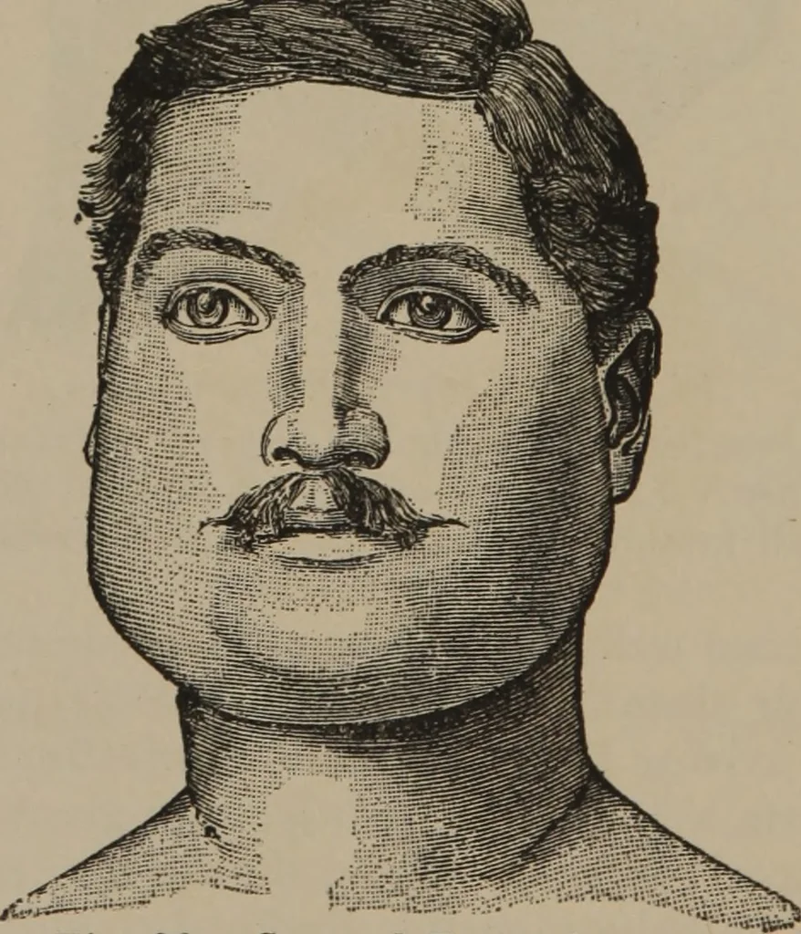 An illustration from The science of facial expression : the new system of diagnosis, based on original researches and discoveries, 1917, leaf 51