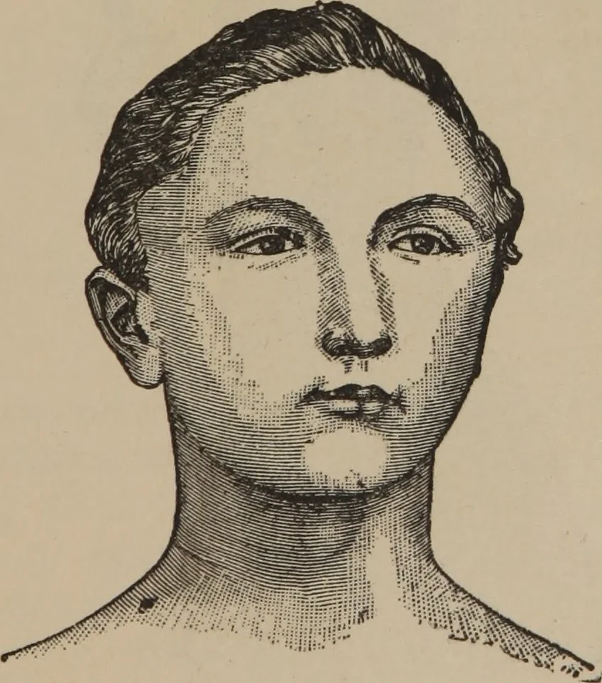 An illustration from The science of facial expression : the new system of diagnosis, based on original researches and discoveries, 1917, leaf 52