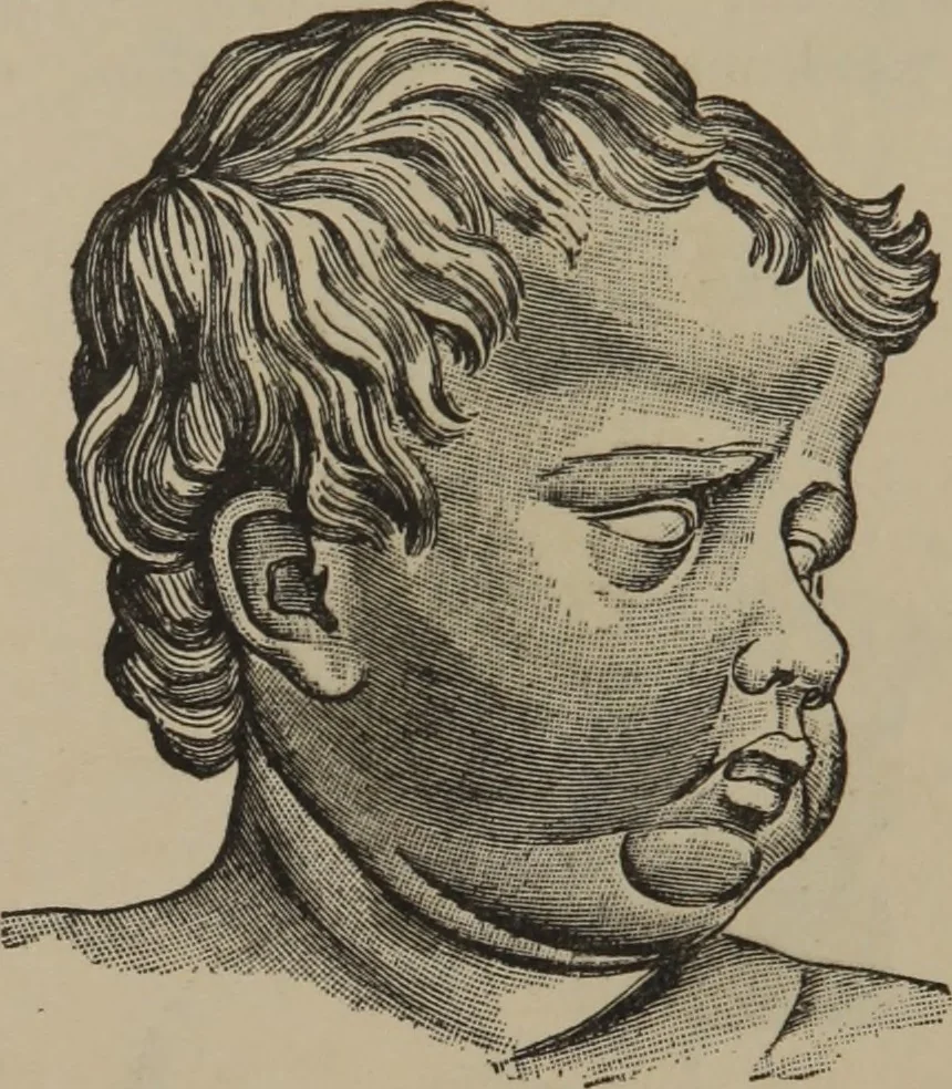An illustration from The science of facial expression : the new system of diagnosis, based on original researches and discoveries, 1917, leaf 55