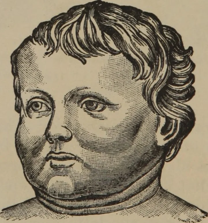 An illustration from The science of facial expression : the new system of diagnosis, based on original researches and discoveries, 1917, leaf 55
