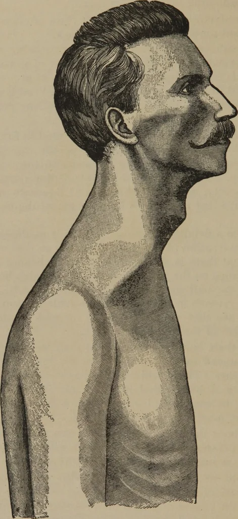 An illustration from The science of facial expression : the new system of diagnosis, based on original researches and discoveries, 1917, leaf 67