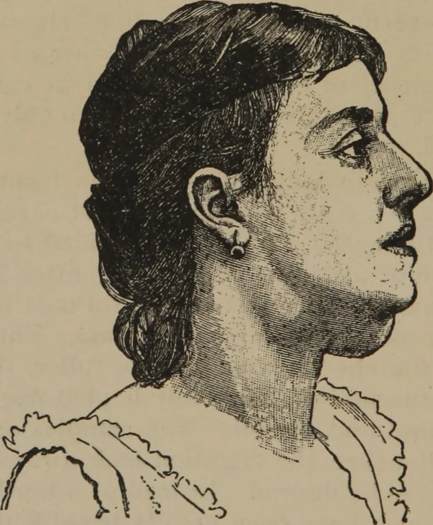 An illustration from The science of facial expression : the new system of diagnosis, based on original researches and discoveries, 1917, leaf 71