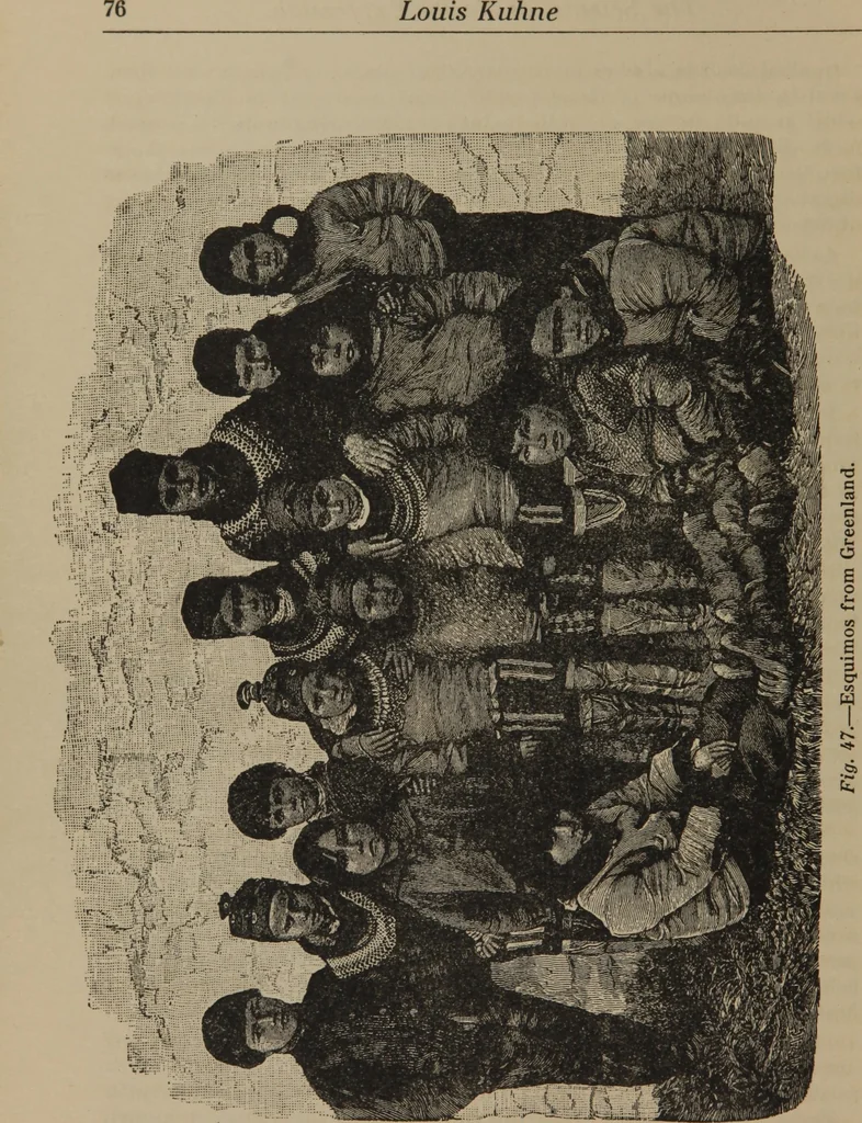 An illustration from The science of facial expression : the new system of diagnosis, based on original researches and discoveries, 1917, leaf 79
