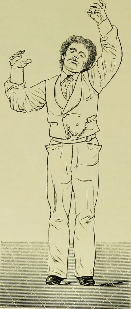 An illustration from Der Hypnotismus; Vorlesungen gehalten an der K. Friedrich-Wilhelms-Universität zu Berlin, 1890, leaf 89