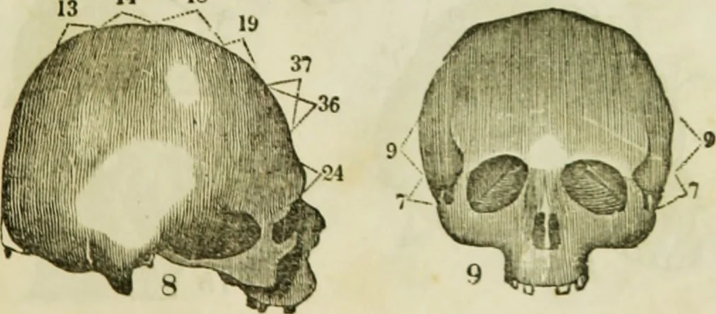 An illustration from Trials and triumphs of an orphan girl : or the biography of Mrs. Deiadamia Chase, physician and phrenologist, 1859, leaf 254