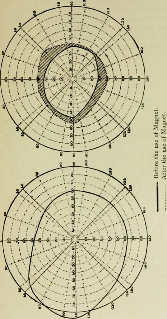 An illustration from Suggestive therapeutics : a treatise on the nature and uses of hypnotism, 1889, leaf 284