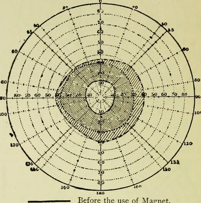 An illustration from Suggestive therapeutics : a treatise on the nature and uses of hypnotism, 1889, leaf 285