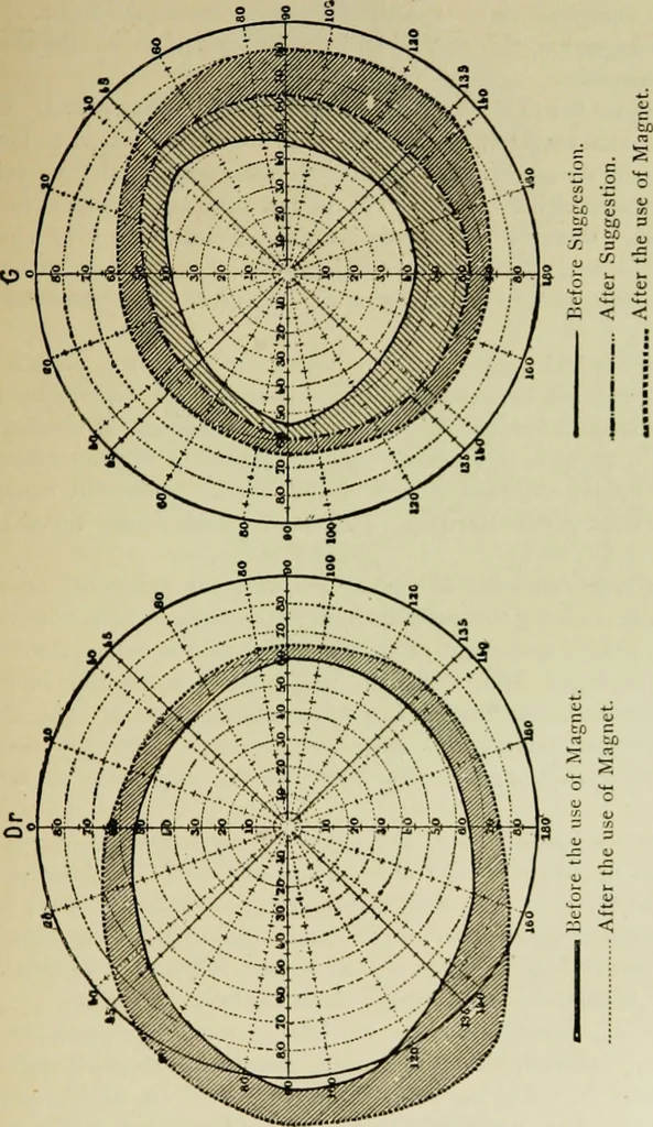 An illustration from Suggestive therapeutics : a treatise on the nature and uses of hypnotism, 1889, leaf 288