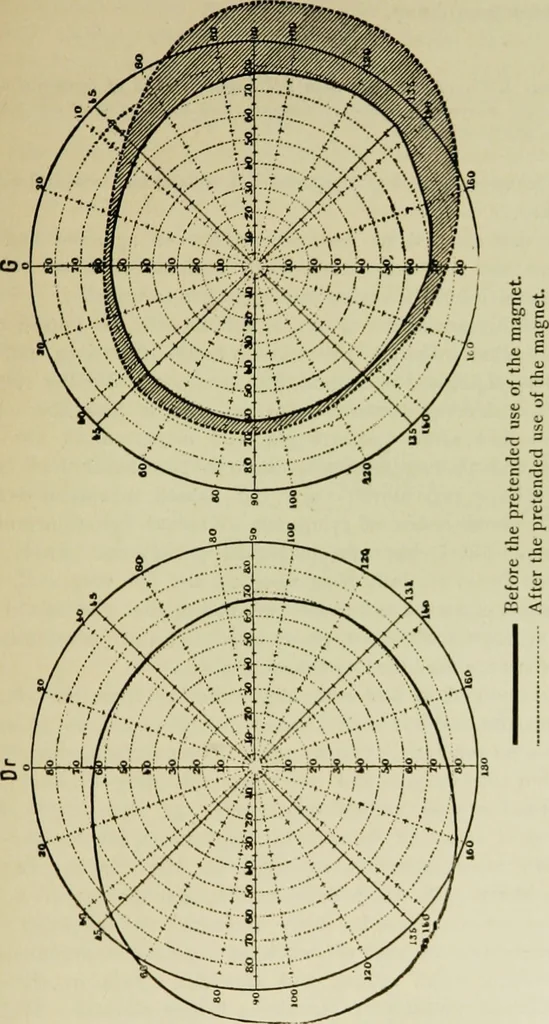 An illustration from Suggestive therapeutics : a treatise on the nature and uses of hypnotism, 1889, leaf 290
