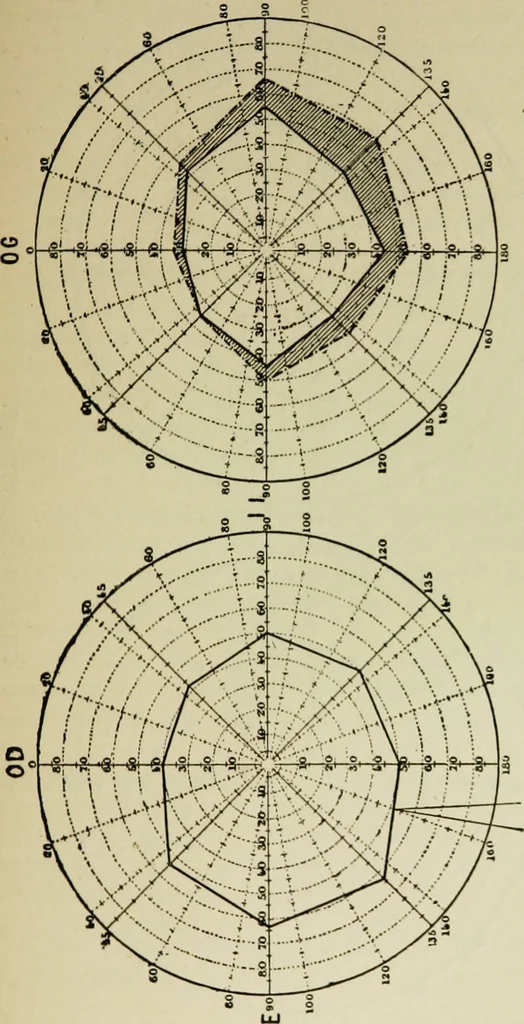 An illustration from Suggestive therapeutics : a treatise on the nature and uses of hypnotism, 1889, leaf 296