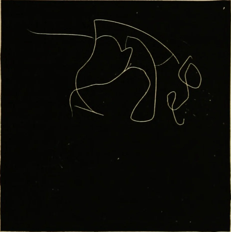 An illustration from Suggestive therapeutics : a treatise on the nature and uses of hypnotism, 1889, leaf 358