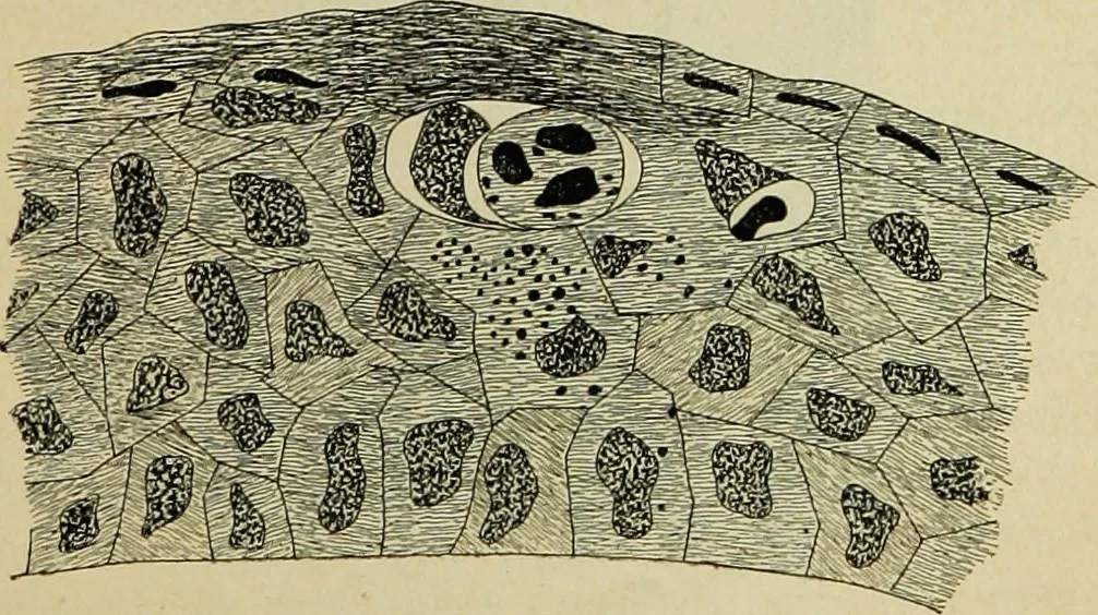 An illustration from Pestilentia in nummis. Geschichte der grossen Volkskrankheiten in numismatischen Documenten. Ein Beitrag zur Geschichte der Medicin und der Cultur, 1882, leaf 276