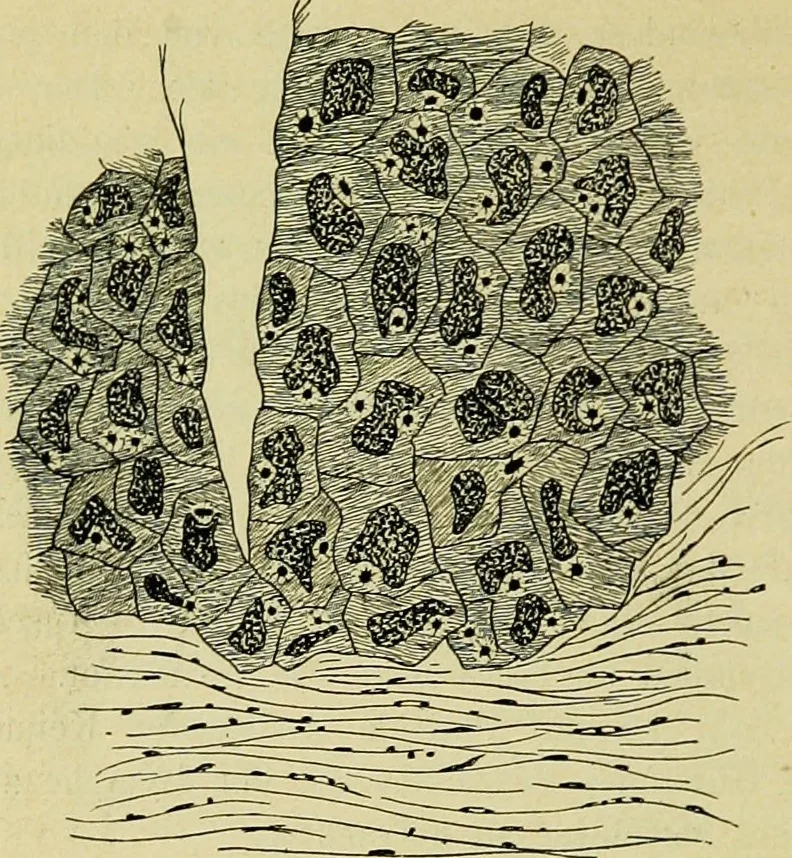 An illustration from Pestilentia in nummis. Geschichte der grossen Volkskrankheiten in numismatischen Documenten. Ein Beitrag zur Geschichte der Medicin und der Cultur, 1882, leaf 277