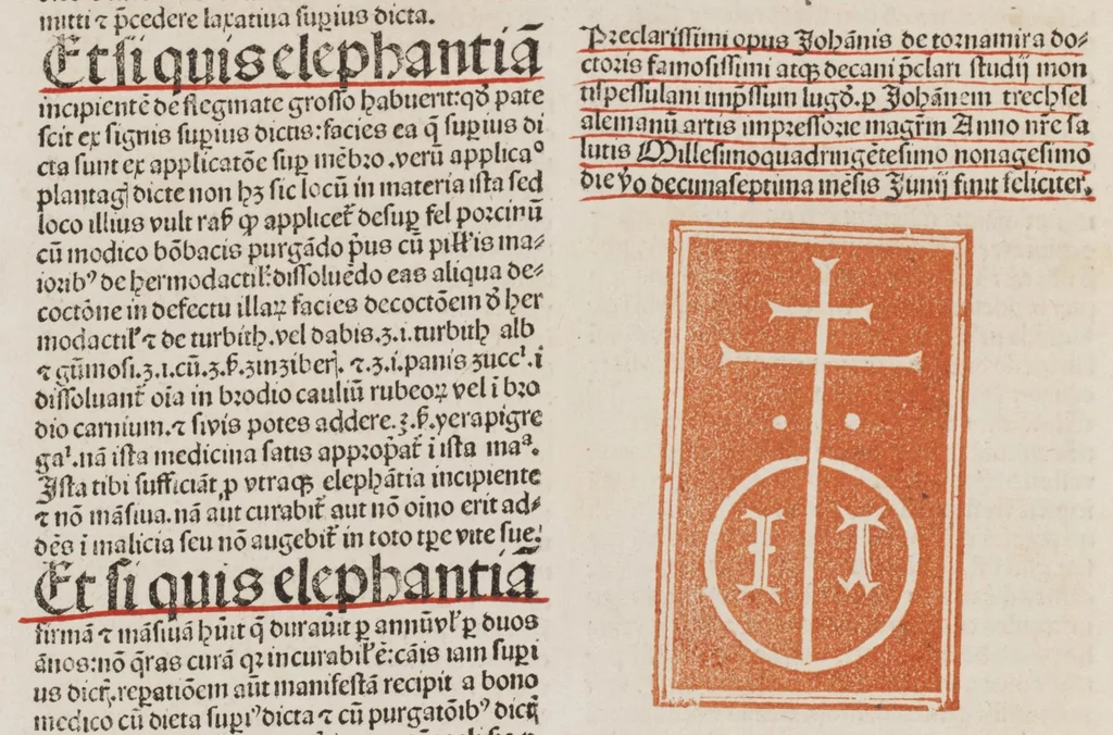 An illustration from Clarificatorium super nono Almansoris cum textu Rhasis, leaf 321