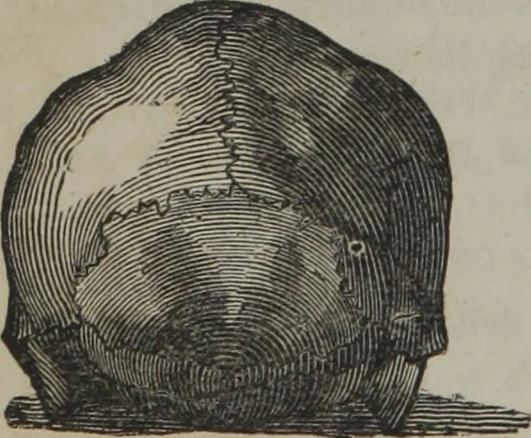 An illustration from A defence of phrenology, 1847, leaf 165