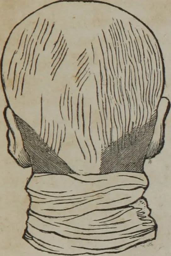 An illustration from A defence of phrenology, 1847, leaf 166