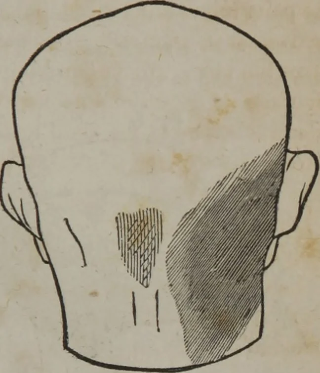 An illustration from A defence of phrenology, 1847, leaf 166